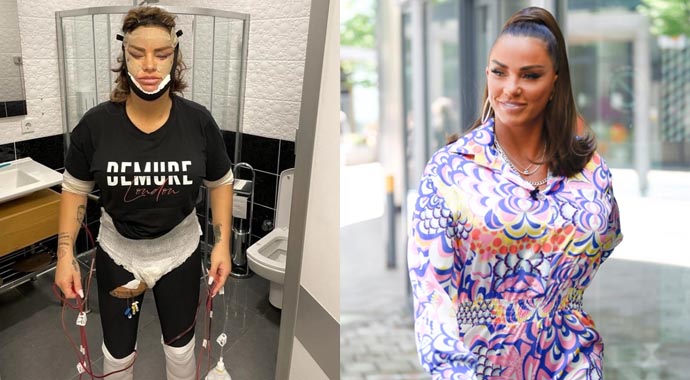 Şarkıcı Katie Price Türkiye'de bıçak altına yattı